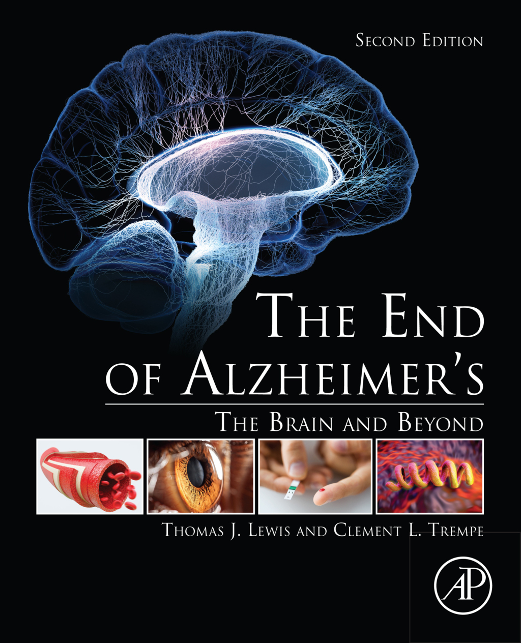The End of AlzheimerÃ¢â‚¬â„¢s The Brain and Beyond 2nd Edition