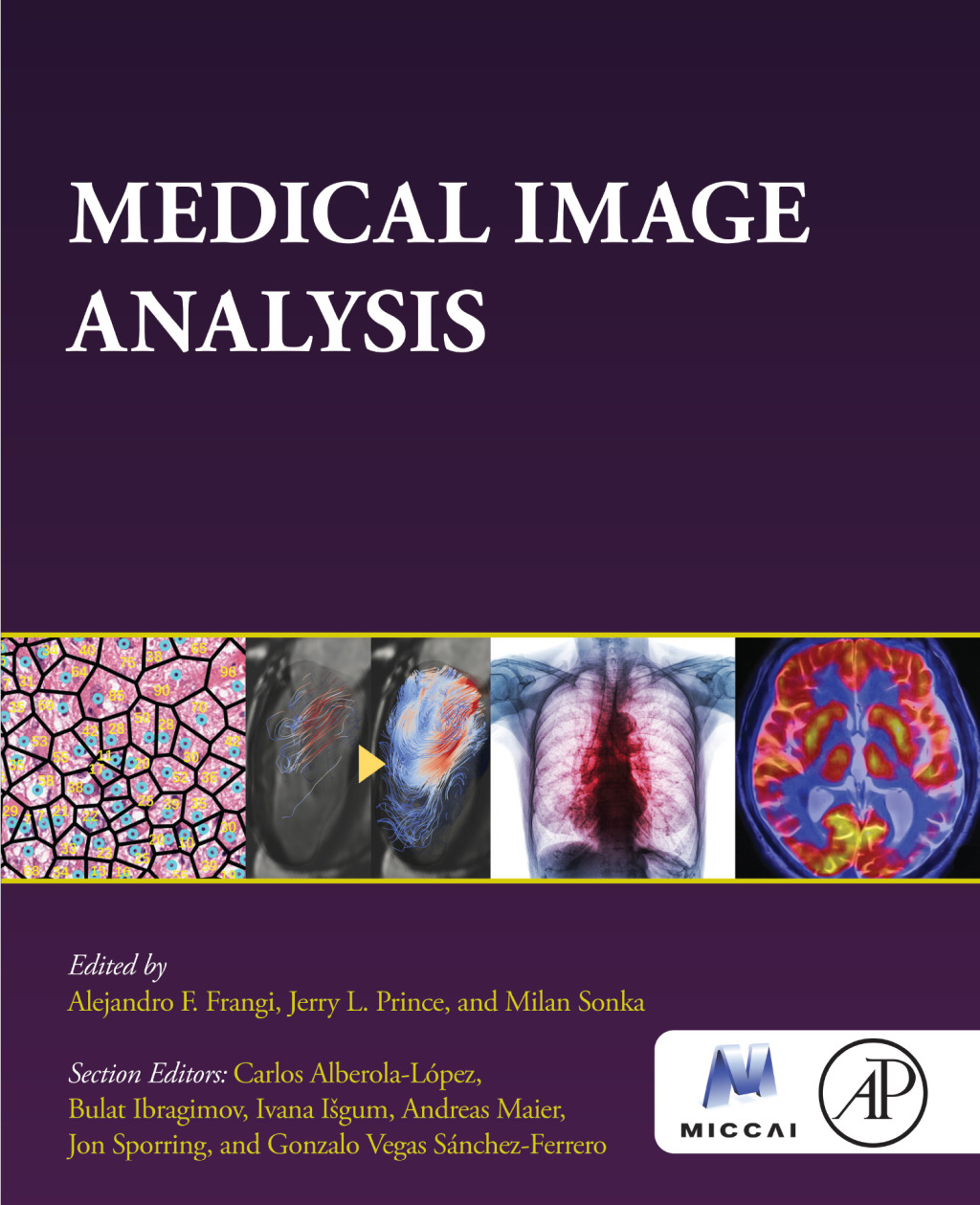 Medical Image Analysis 1st Edition