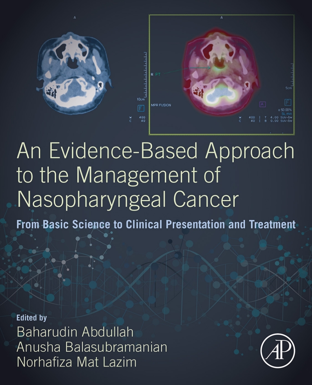 An Evidence-Based Approach to the Management of Nasopharyngeal Cancer From Basic Science to Clinical Presentation and Treatment 1st Edition