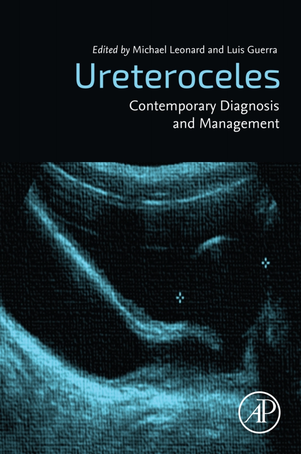 Ureteroceles Contemporary Diagnosis and Management 1st Edition