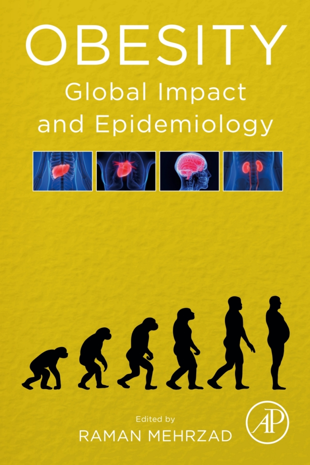 Obesity Global Impact and Epidemiology 1st Edition
