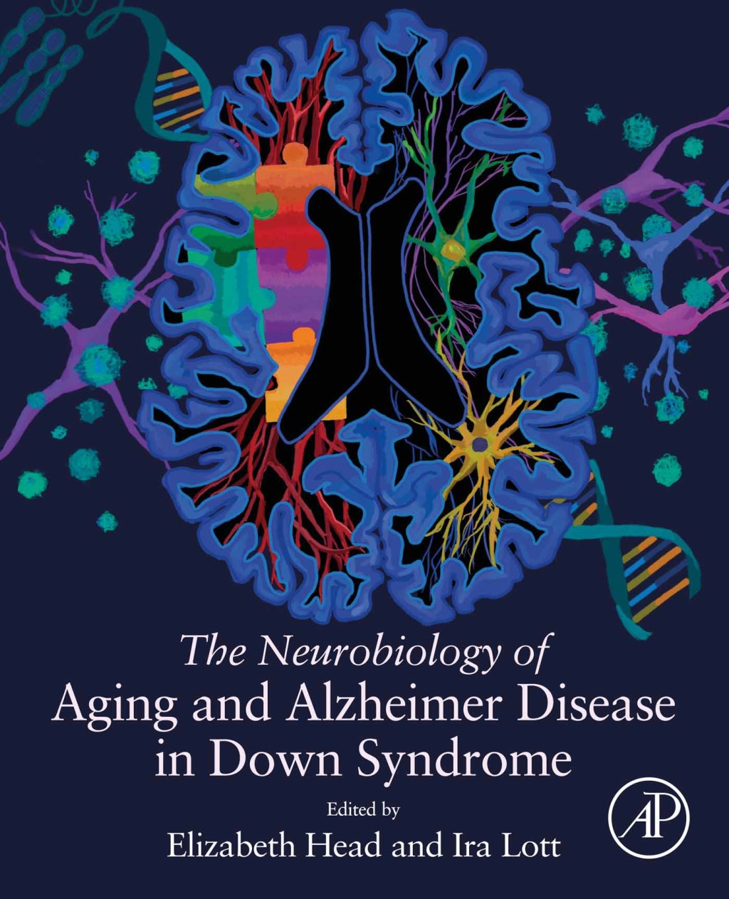 The Neurobiology of Aging and Alzheimer Disease in Down Syndrome 