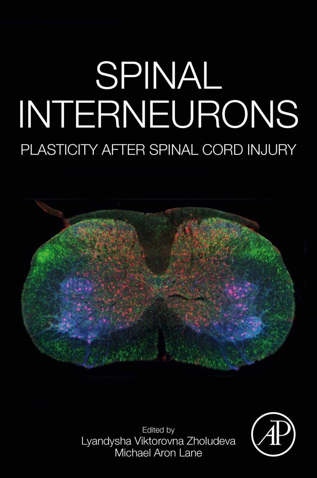 Spinal Interneurons Plasticity after Spinal Cord Injury 1st Edition