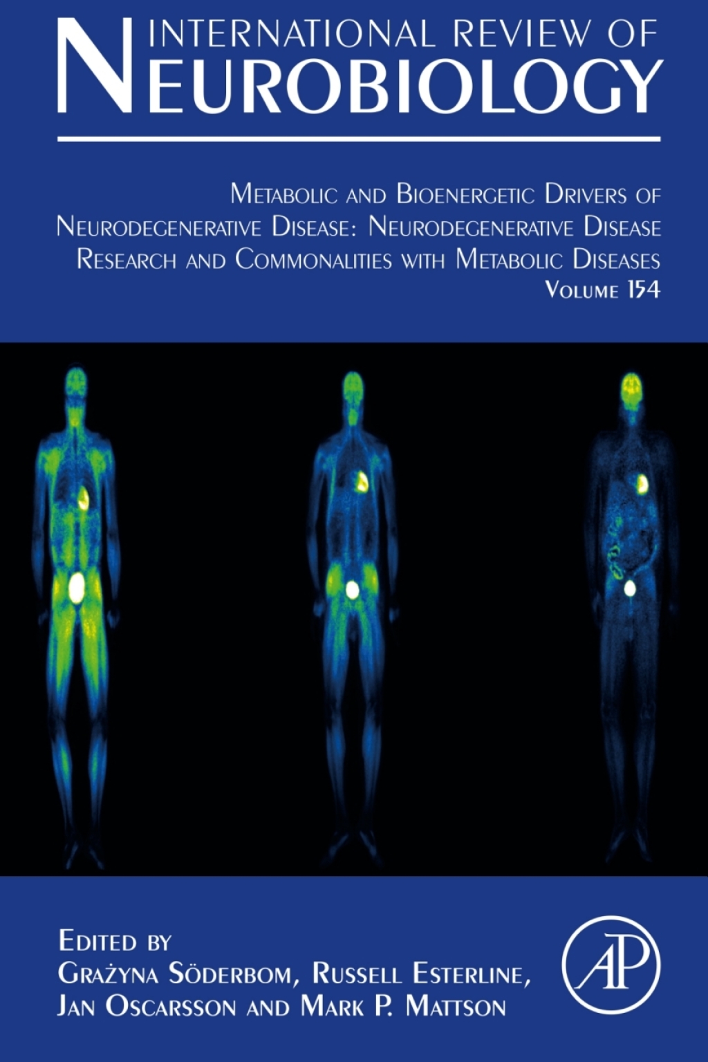Metabolic and Bioenergetic Drivers of Neurodegenerative Disease: Neurodegenerative Disease Research and Commonalities with Metabolic Diseases 1st Edition