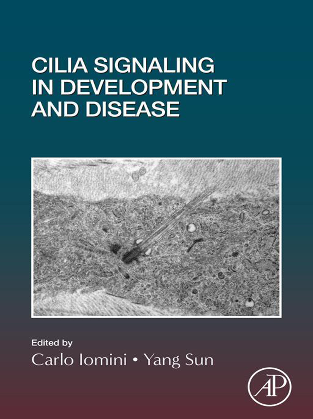 Cilia Signaling in Development and Disease 1st Edition
