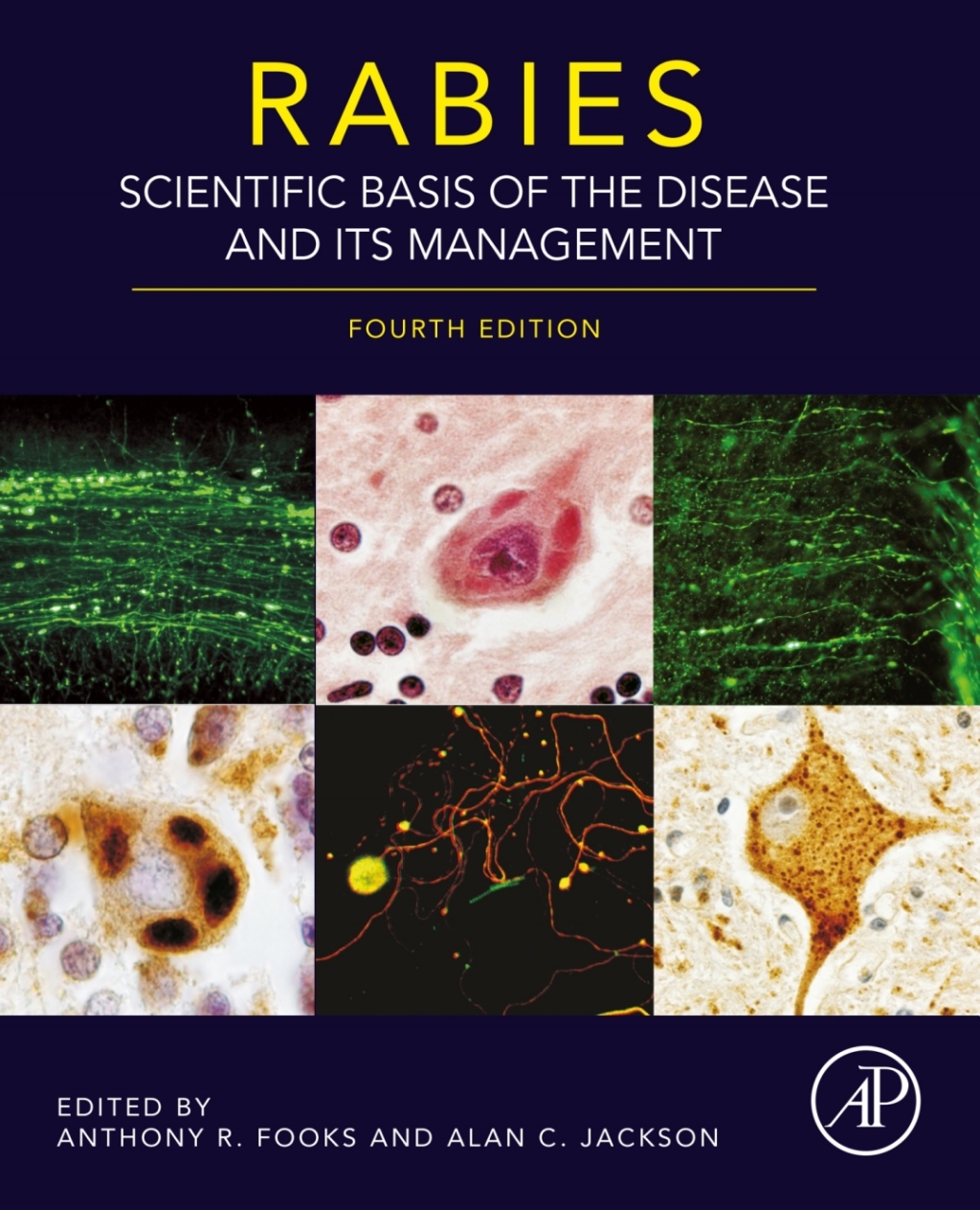 Rabies Scientific Basis of the Disease and Its Management 4th Edition