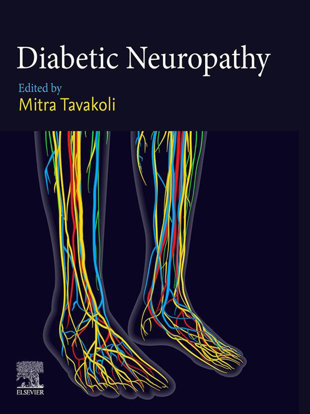 Diabetic Neuropathy 