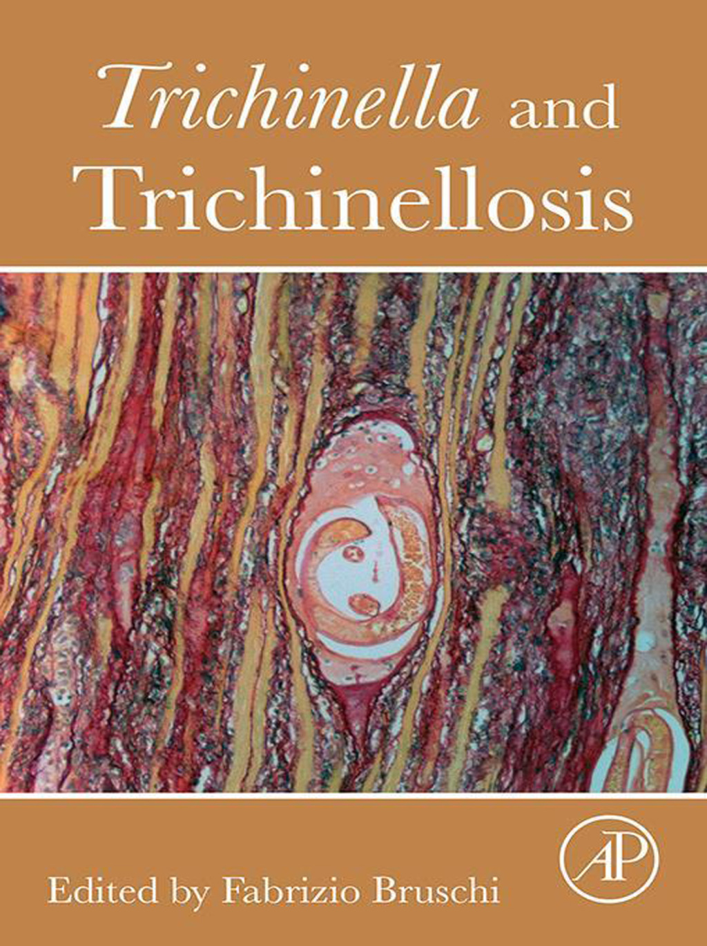 Trichinella and Trichinellosis 