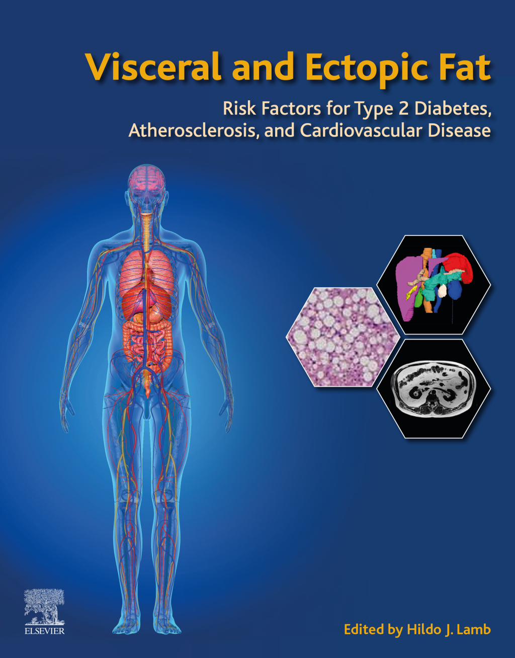 Visceral and Ectopic Fat Risk Factors for Type 2 Diabetes, Atherosclerosis, and Cardiovascular Disease 1st Edition