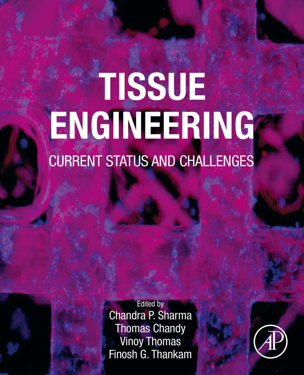 Tissue Engineering Current Status and Challenges 