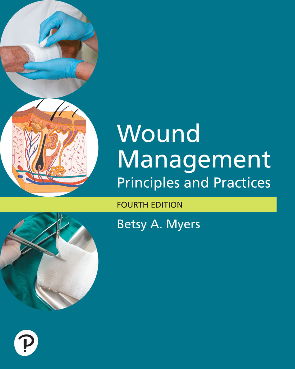 Wound Management: Principles and Practice 4th Edition