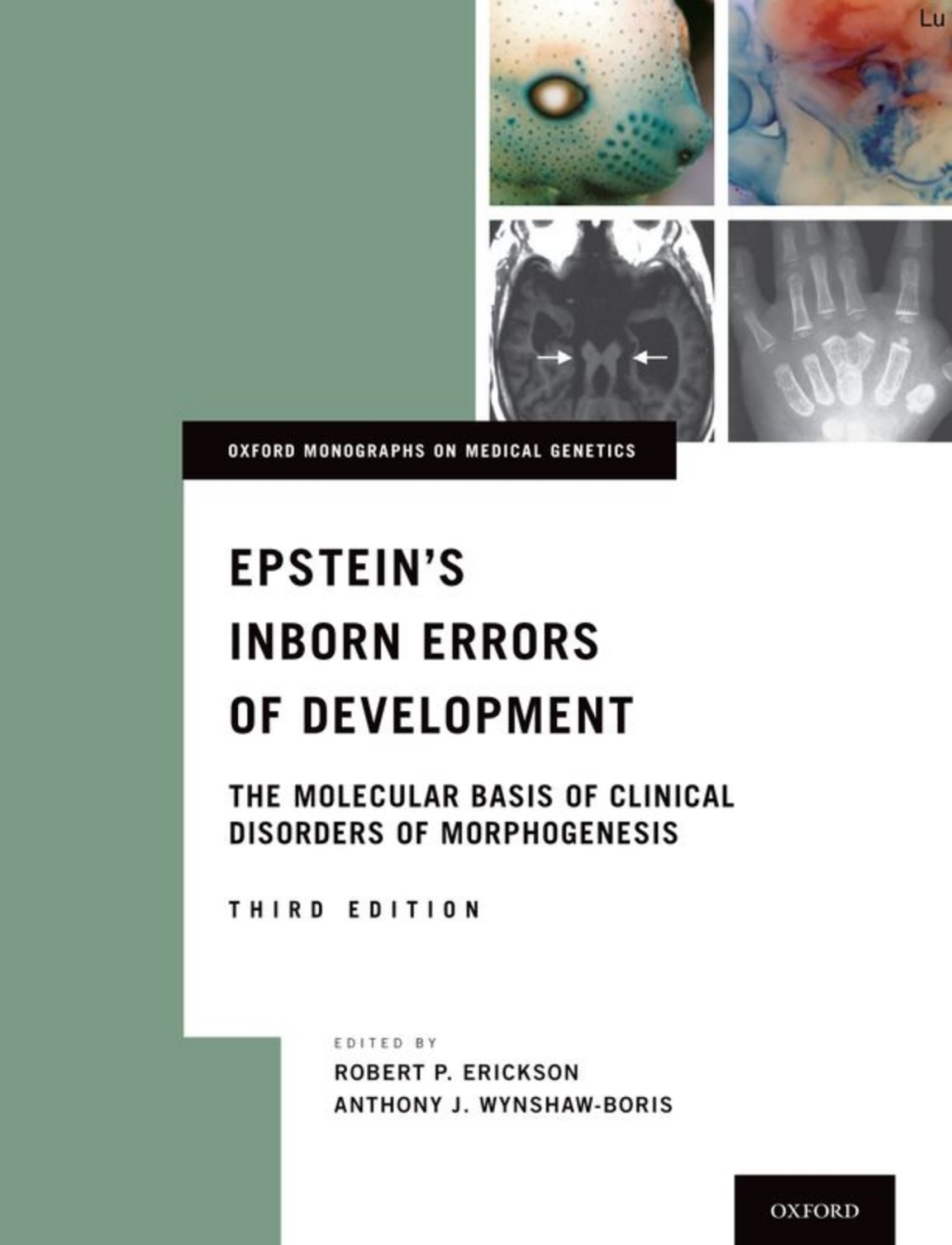 Epstein's Inborn Errors of Development The Molecular Basis of Clinical Disorders of Morphogenesis 3rd Edition