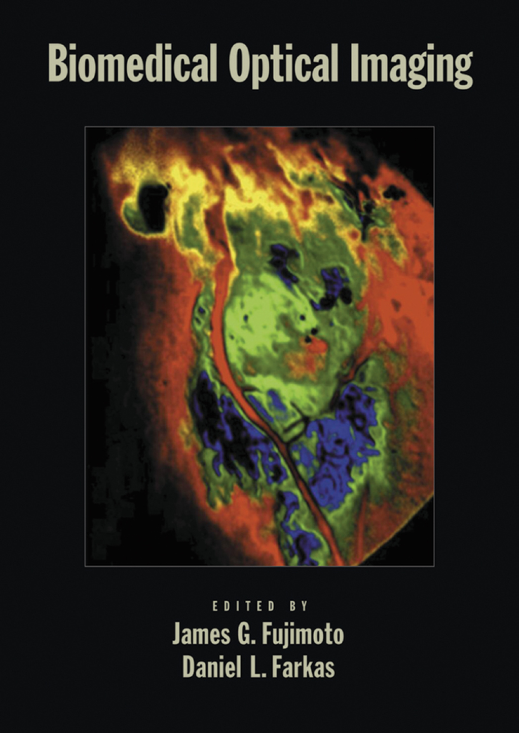 Biomedical Optical Imaging 