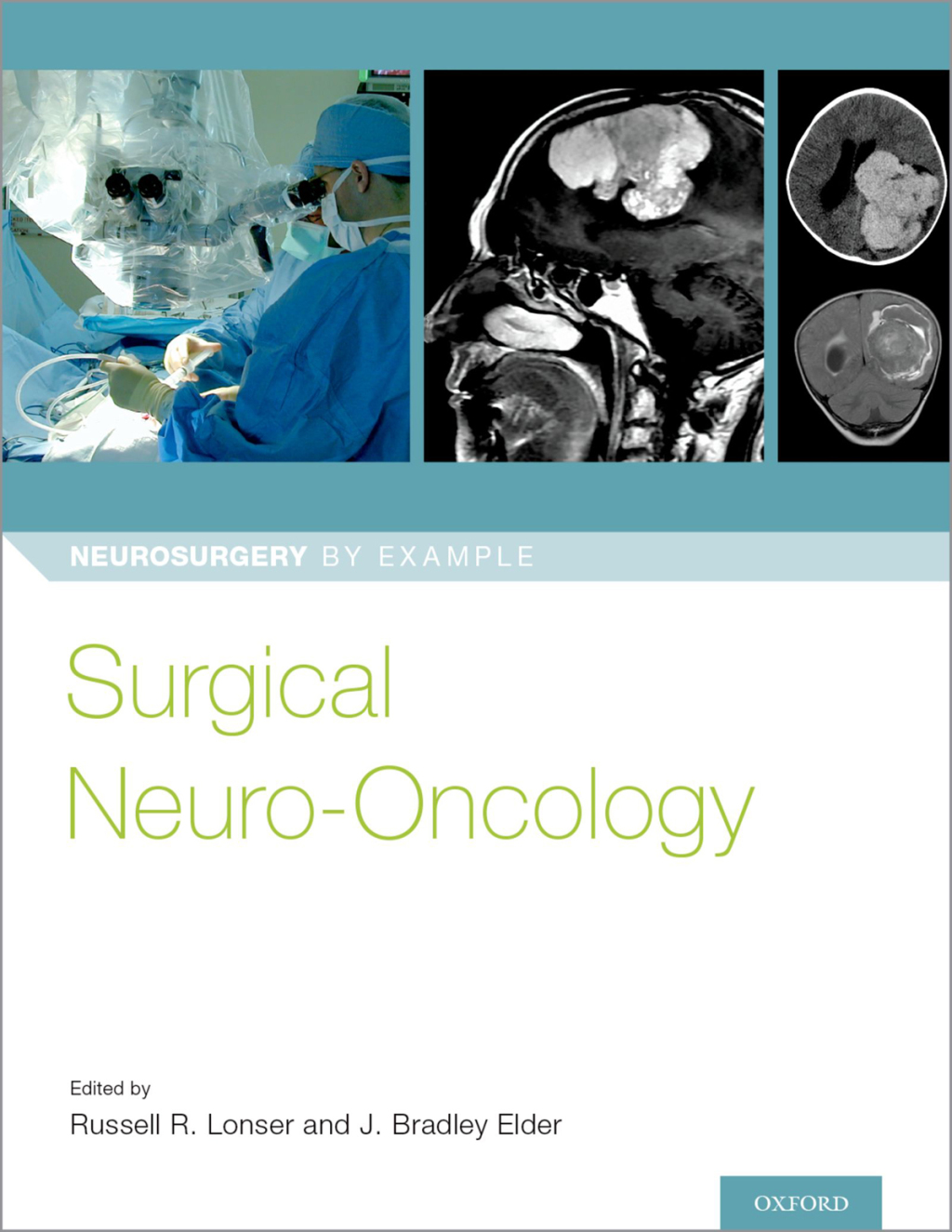 Surgical Neuro-Oncology 1st Edition