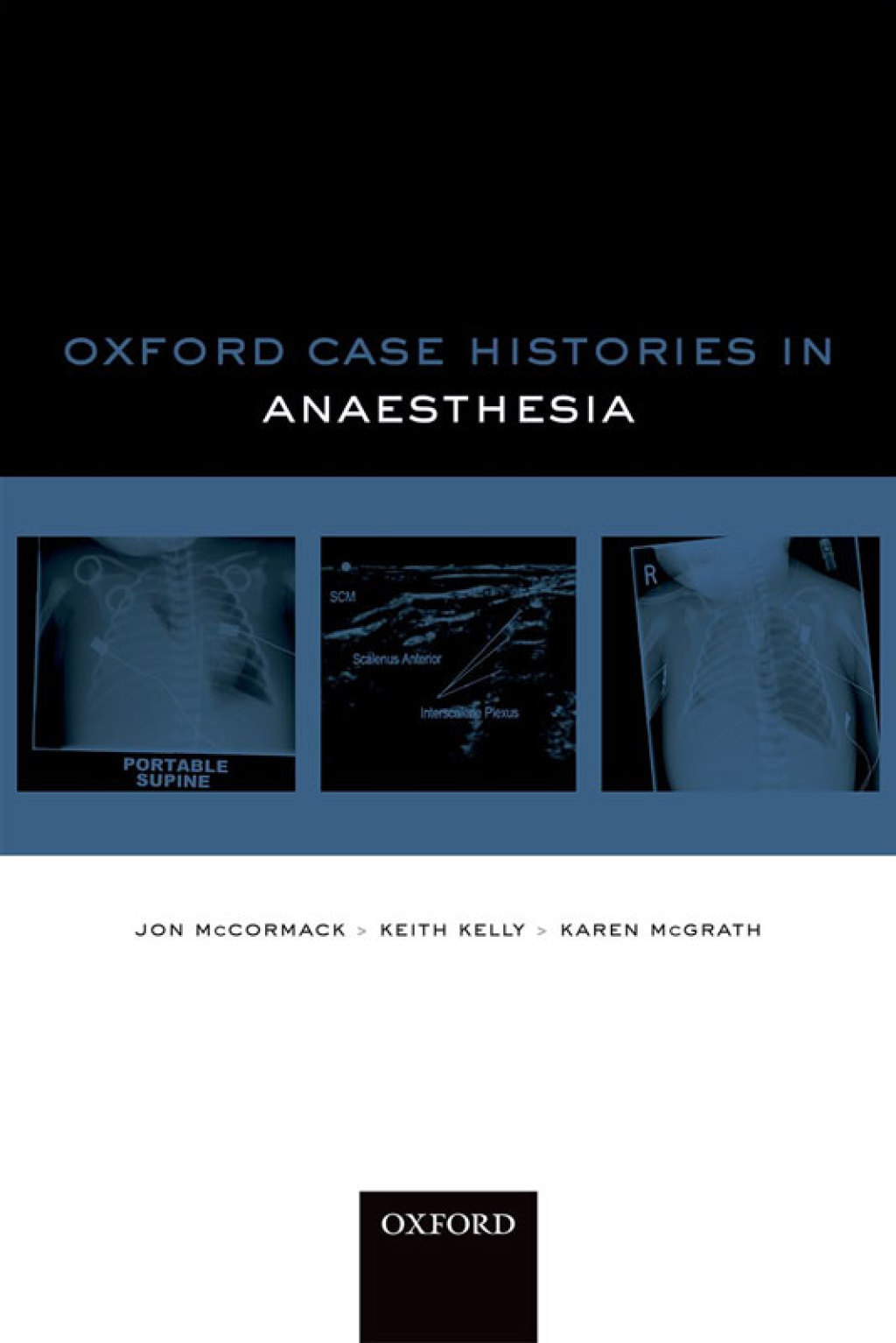 Oxford Case Histories in Anaesthesia 1st Edition