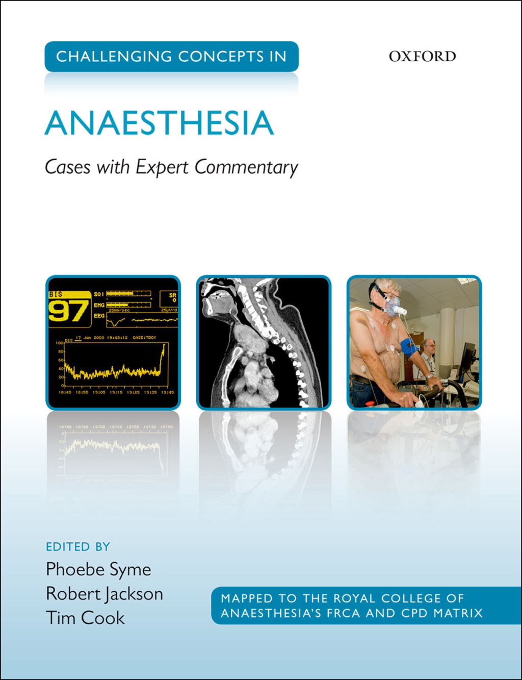 Challenging Concepts in Anaesthesia Cases with Expert Commentary 1st Edition
