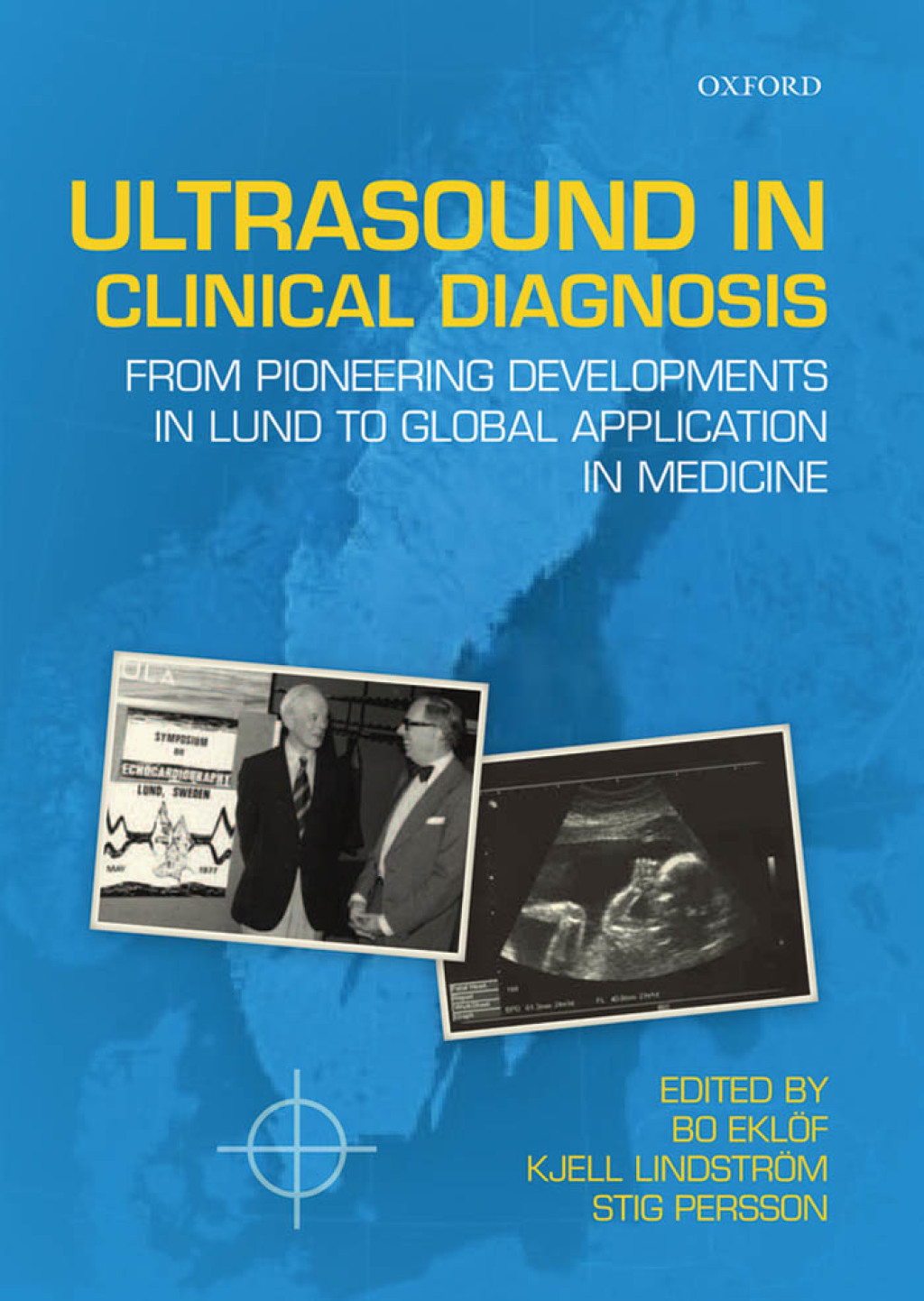 Ultrasound in Clinical Diagnosis From pioneering developments in Lund to global application in medicine 1st Edition