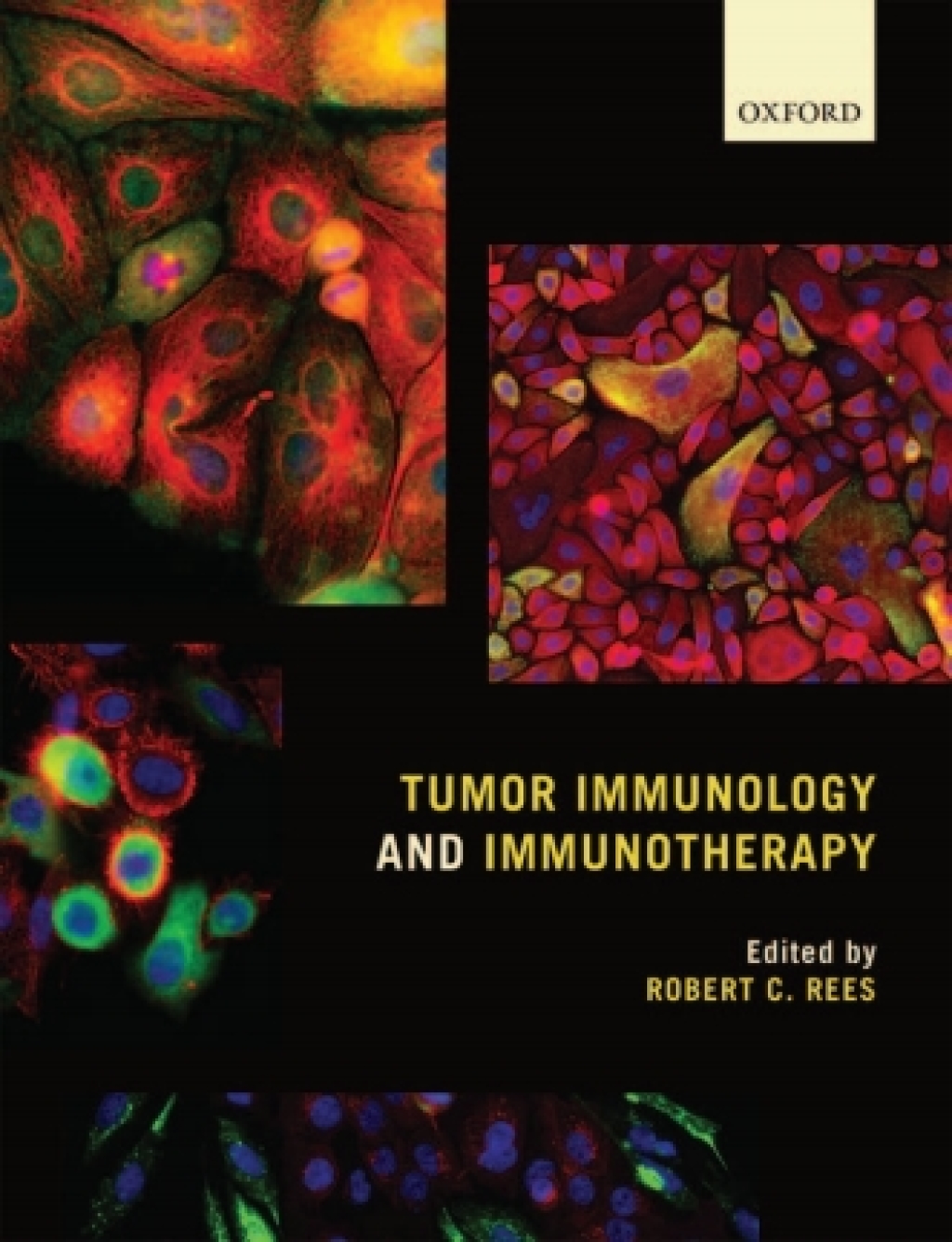 Tumor Immunology and Immunotherapy 1st Edition