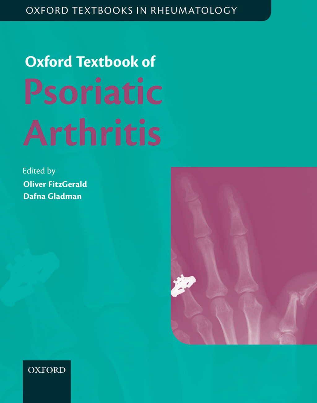 Oxford Textbook of Psoriatic Arthritis 1st Edition