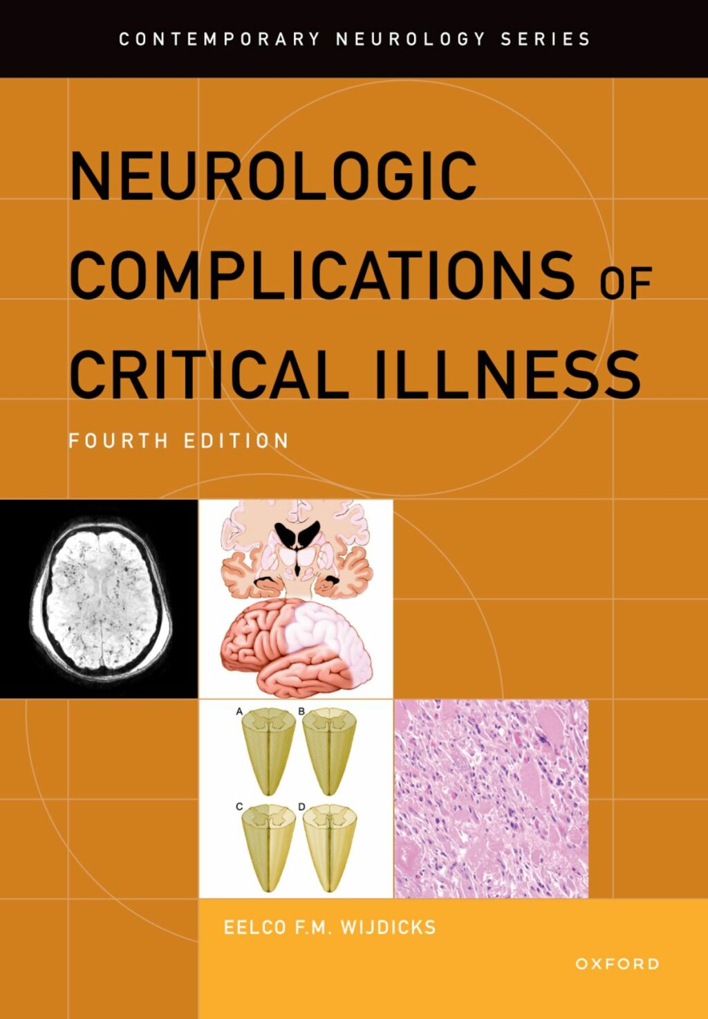 Neurologic Complications of Critical Illness 4th Edition