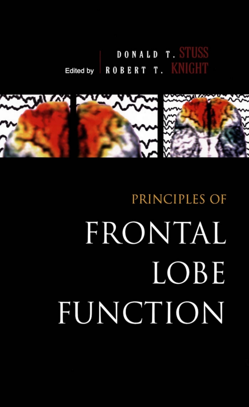 Principles of Frontal Lobe Function 1st Edition
