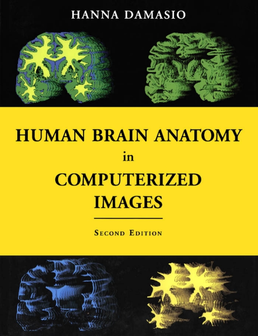 Human Brain Anatomy in Computerized Images 2nd Edition