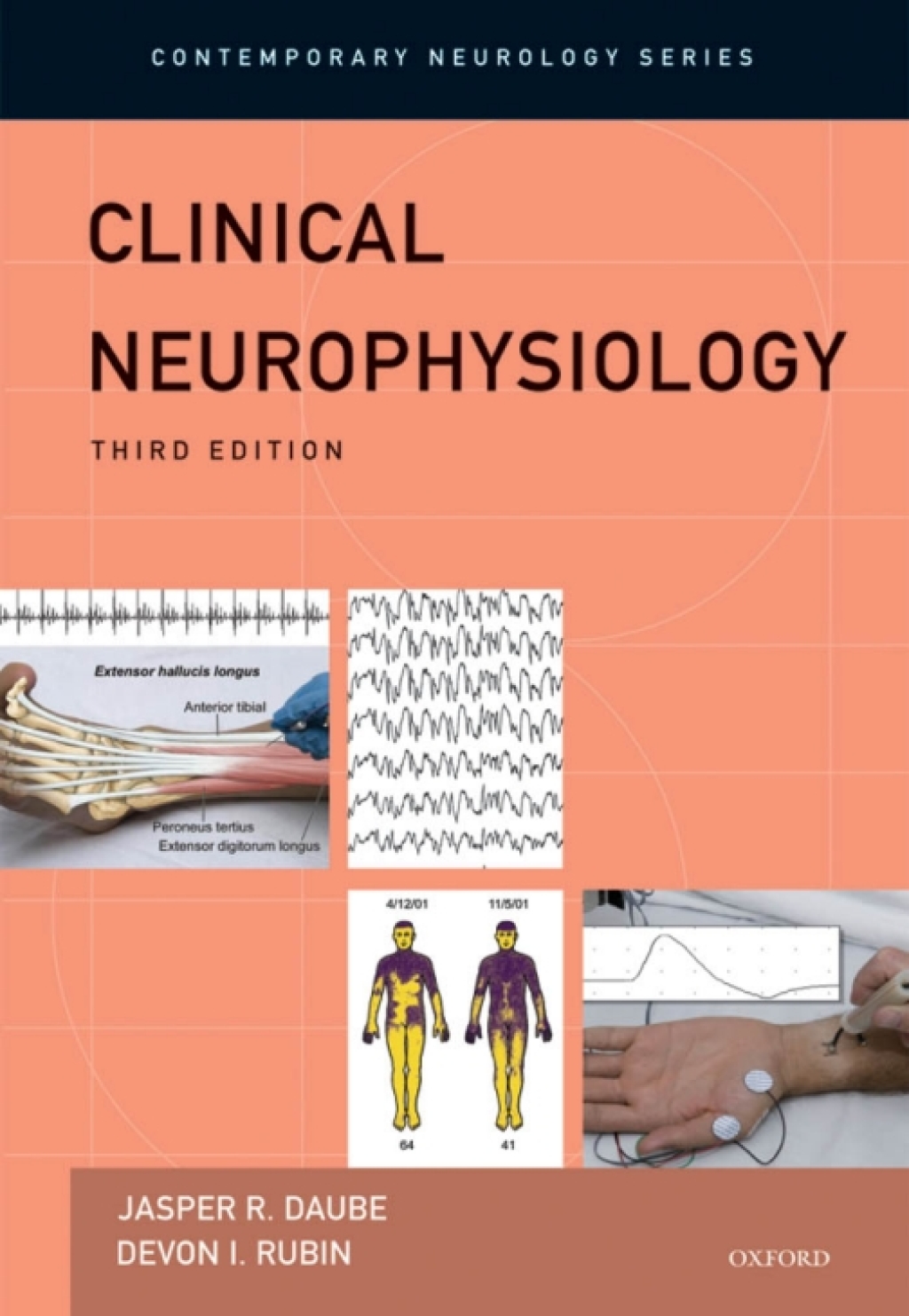 Clinical Neurophysiology 3rd Edition