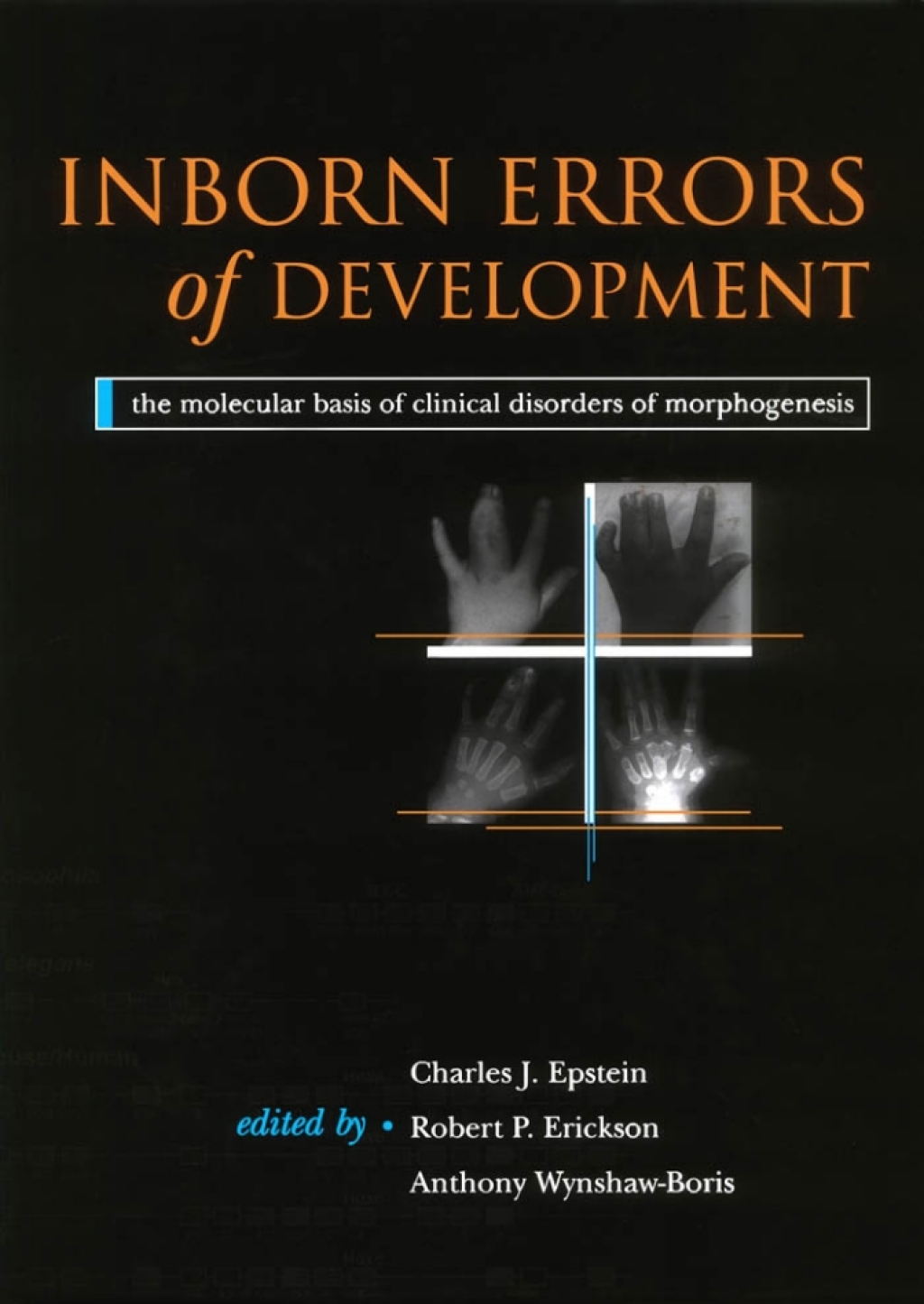 Inborn Errors of Development The Molecular Basis of Clinical Disorders of Morphogenesis 1st Edition