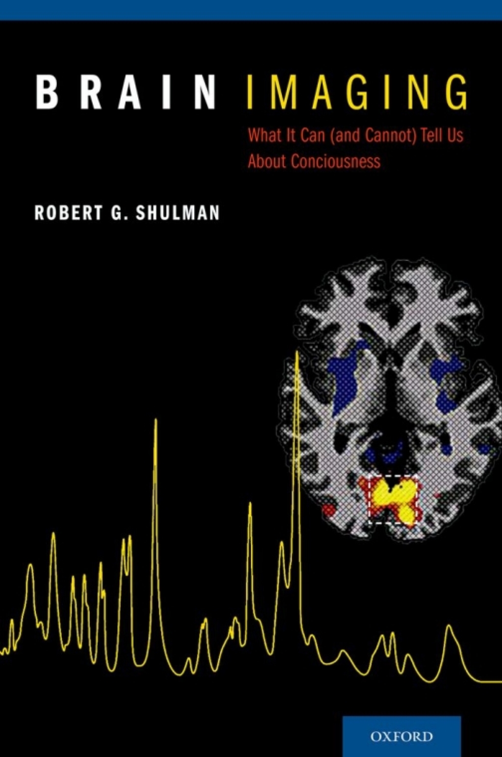 Brain Imaging What it Can (and Cannot) Tell Us About Consciousness 
