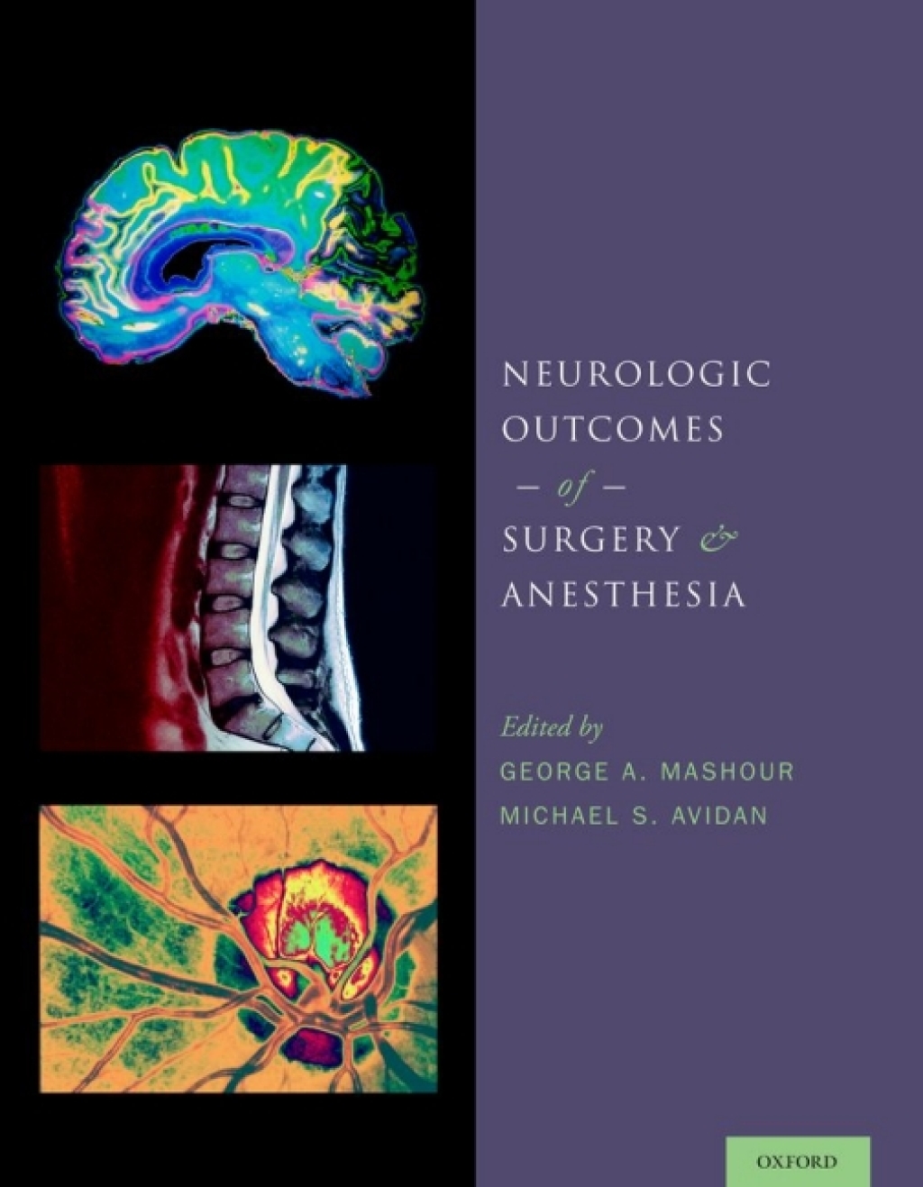 Neurologic Outcomes of Surgery and Anesthesia 1st Edition