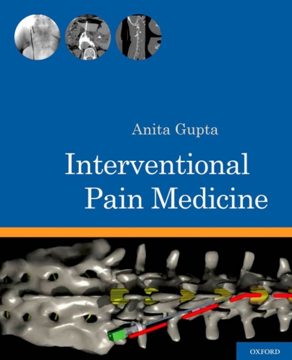 Interventional Pain Medicine 1st Edition