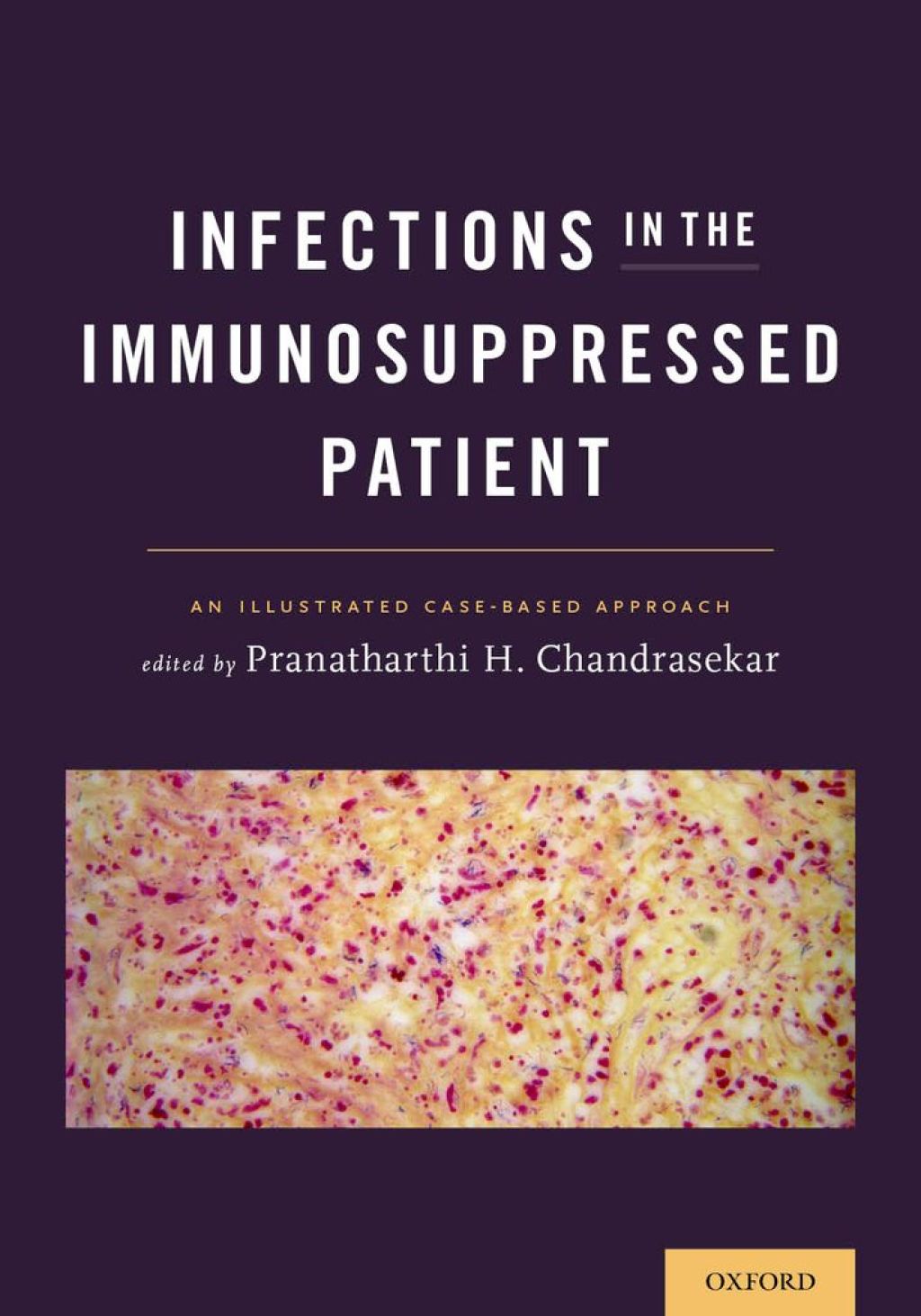 Infections in the Immunosuppressed Patient An Illustrated Case-Based Approach 1st Edition