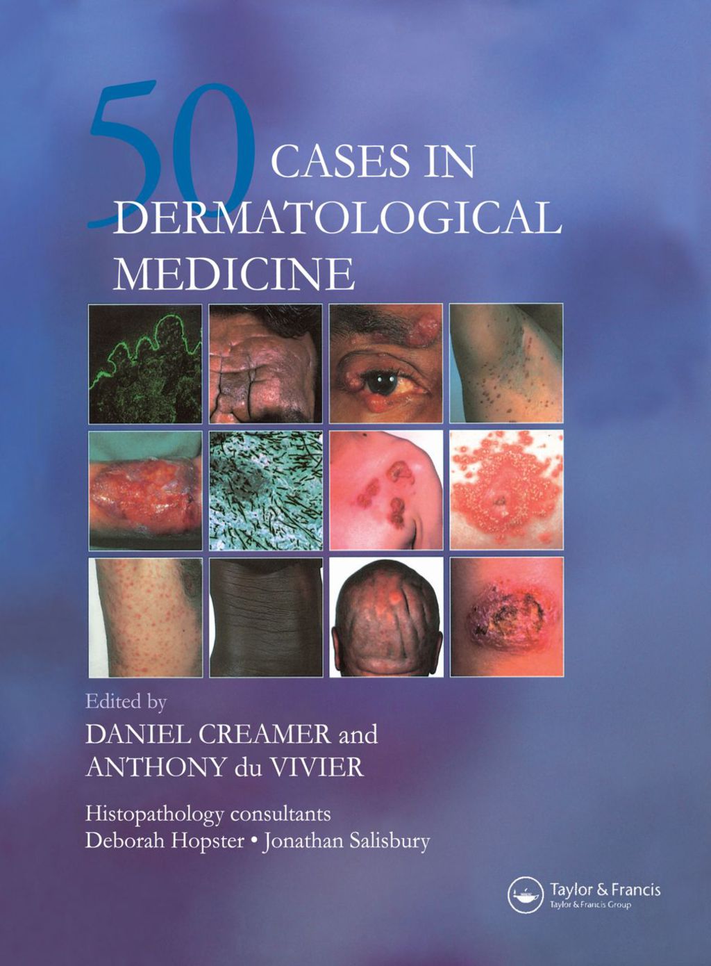 Fifty Dermatological Cases 1st Edition