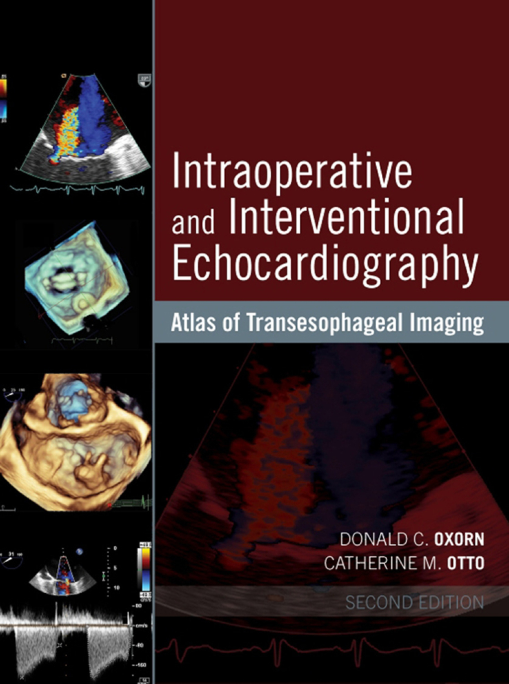 Intraoperative and Interventional Echocardiography Atlas of Transesophageal Imaging 2nd Edition
