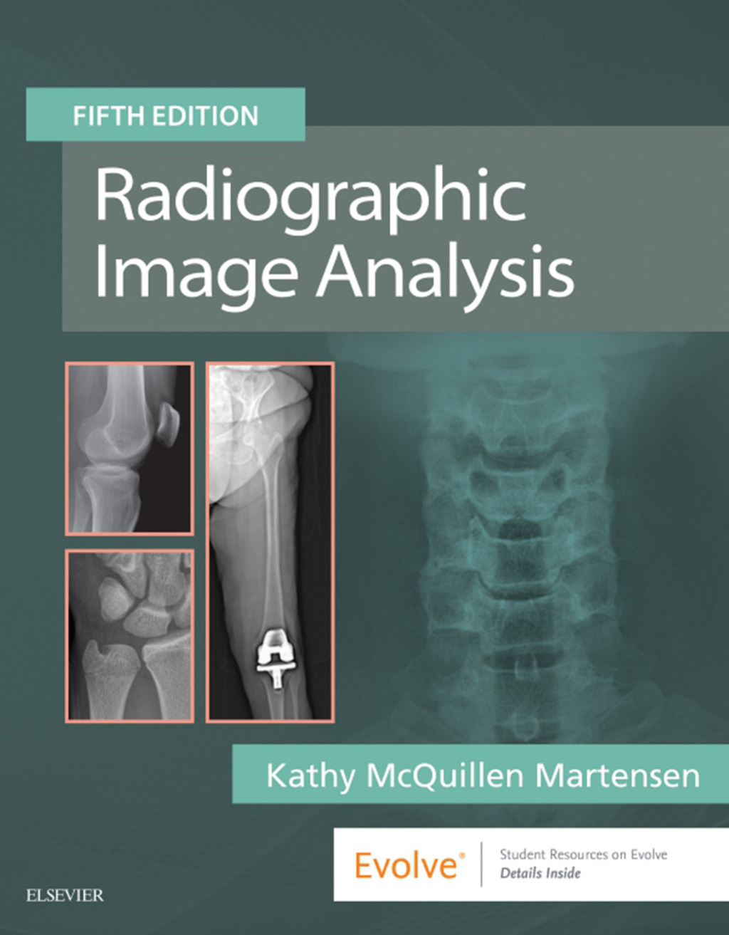 Radiographic Image Analysis 5th Edition