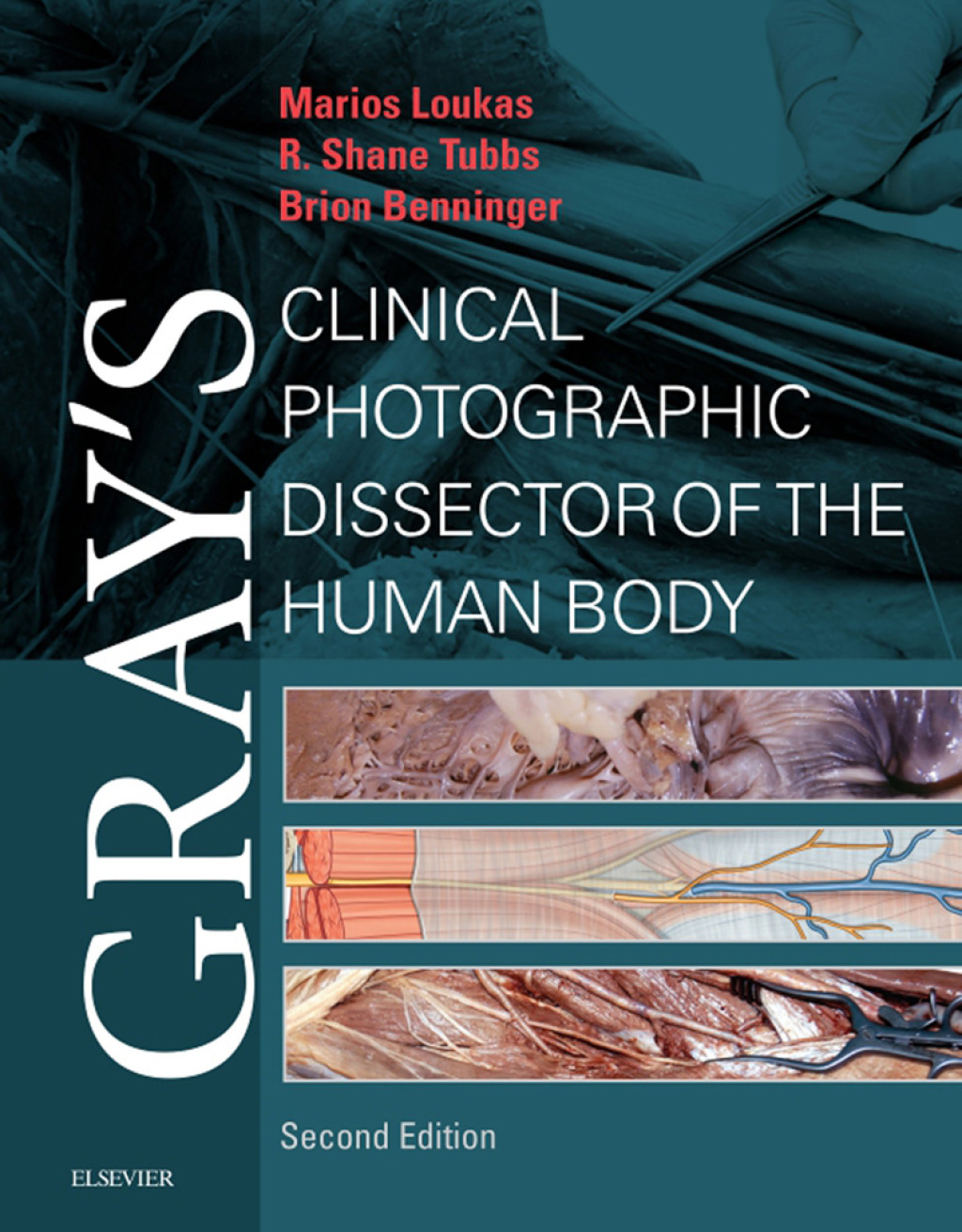 Gray's Clinical Photographic Dissector of the Human Body 2nd Edition