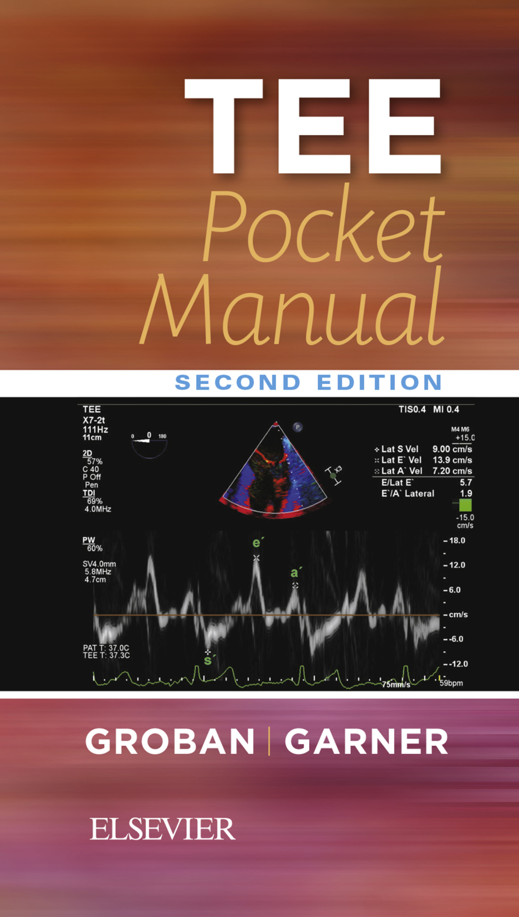 TEE Pocket Manual 2nd Edition