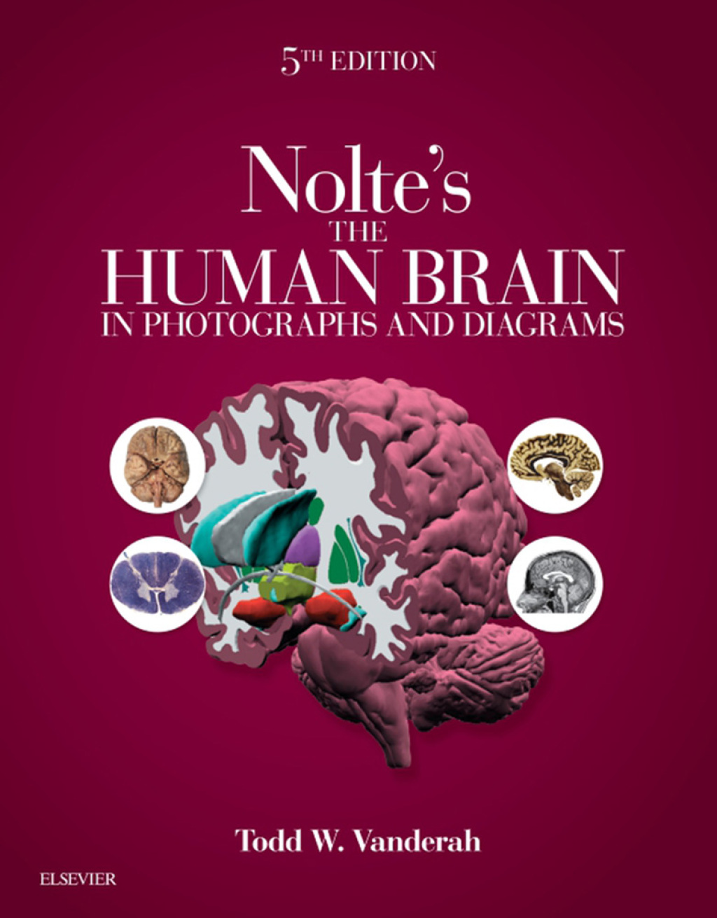 Nolte's The Human Brain in Photographs and Diagrams 5th Edition