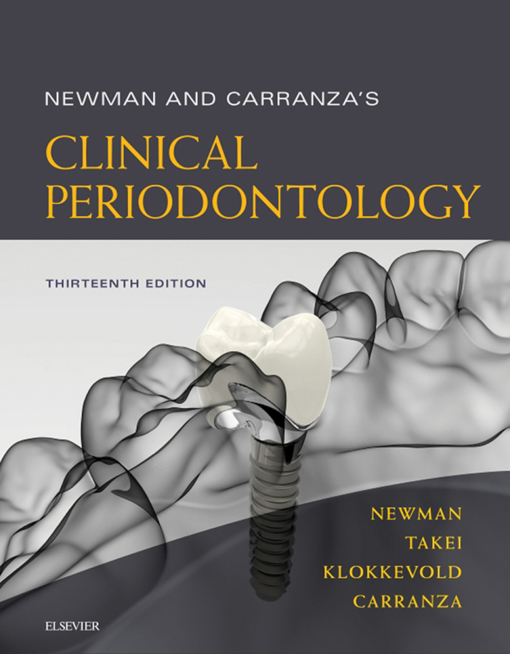 Newman and Carranza's Clinical Periodontology E-Book Expert Consult 13th Edition