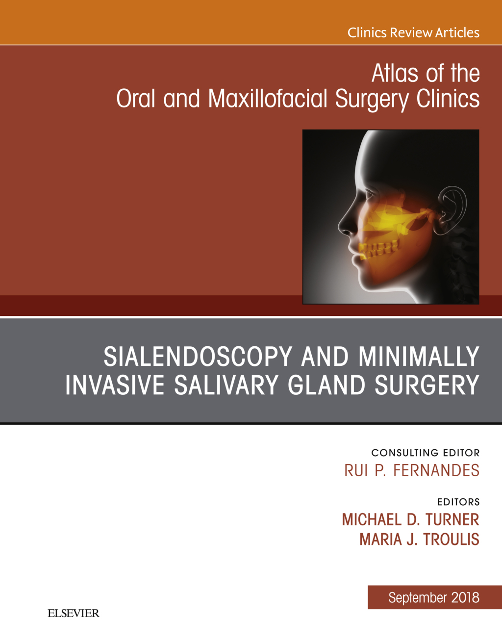 Sialendoscopy, An Issue of Atlas of the Oral & Maxillofacial Surgery Clinics 