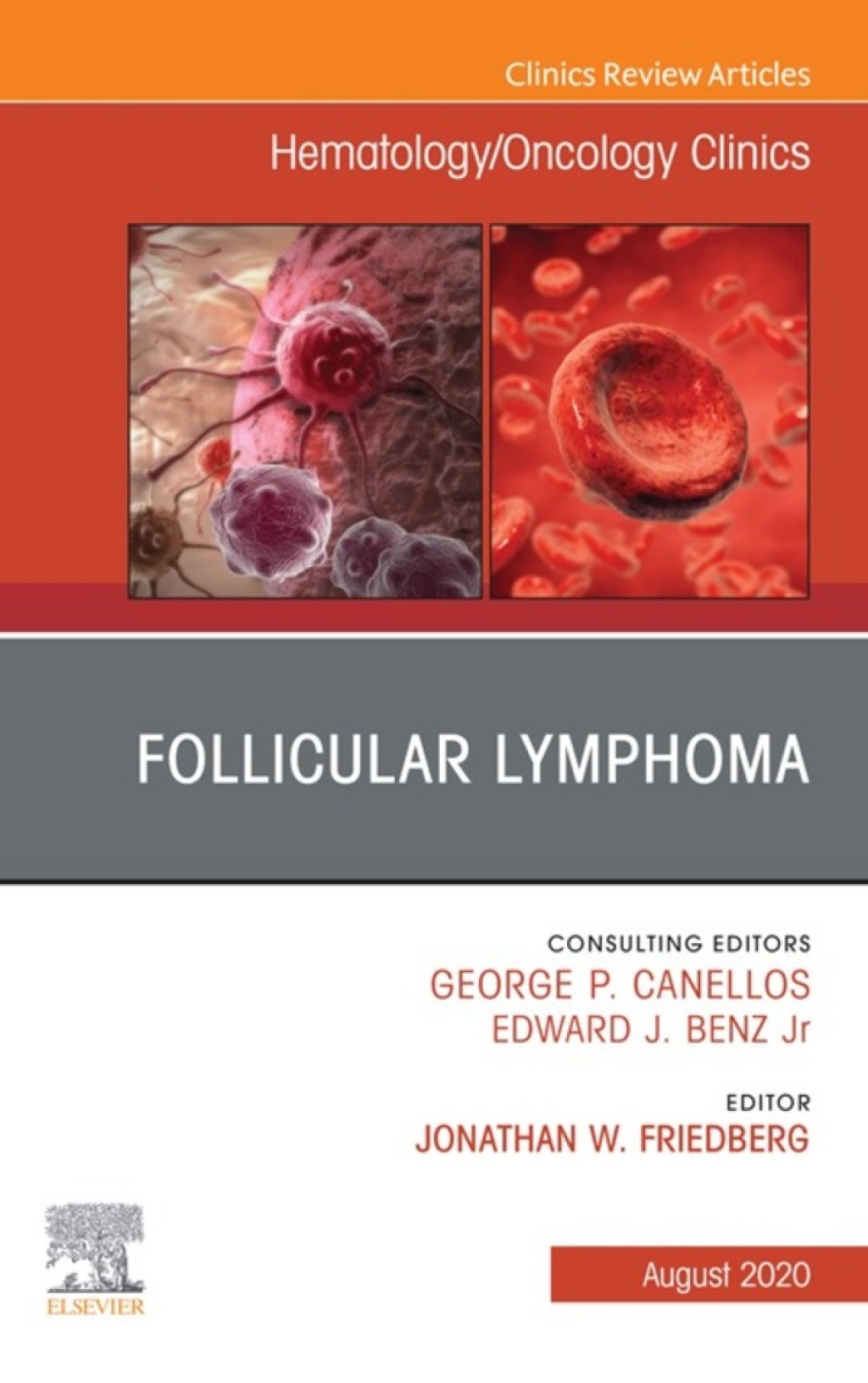 Follicular Lymphoma, An Issue of Hematology/Oncology Clinics of North America 1st Edition