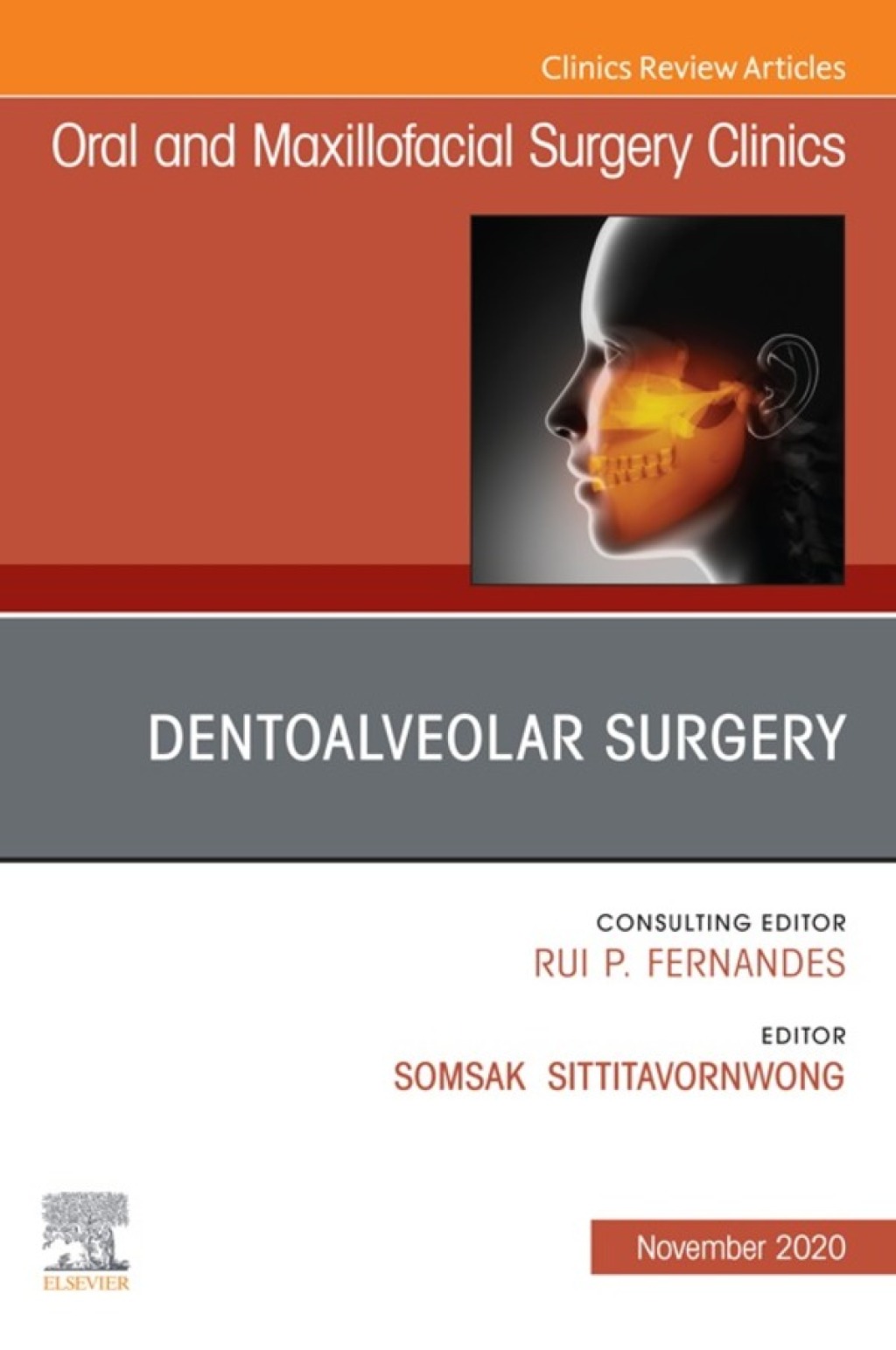 Dentoalveolar Surgery, An Issue of Oral and Maxillofacial Surgery Clinics of North America 1st Edition