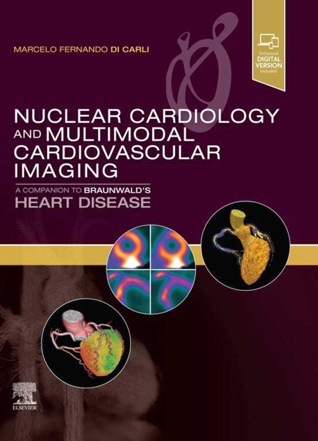 Nuclear Cardiology and Multimodal Cardiovascular Imaging A Companion to Braunwald's Heart Disease 