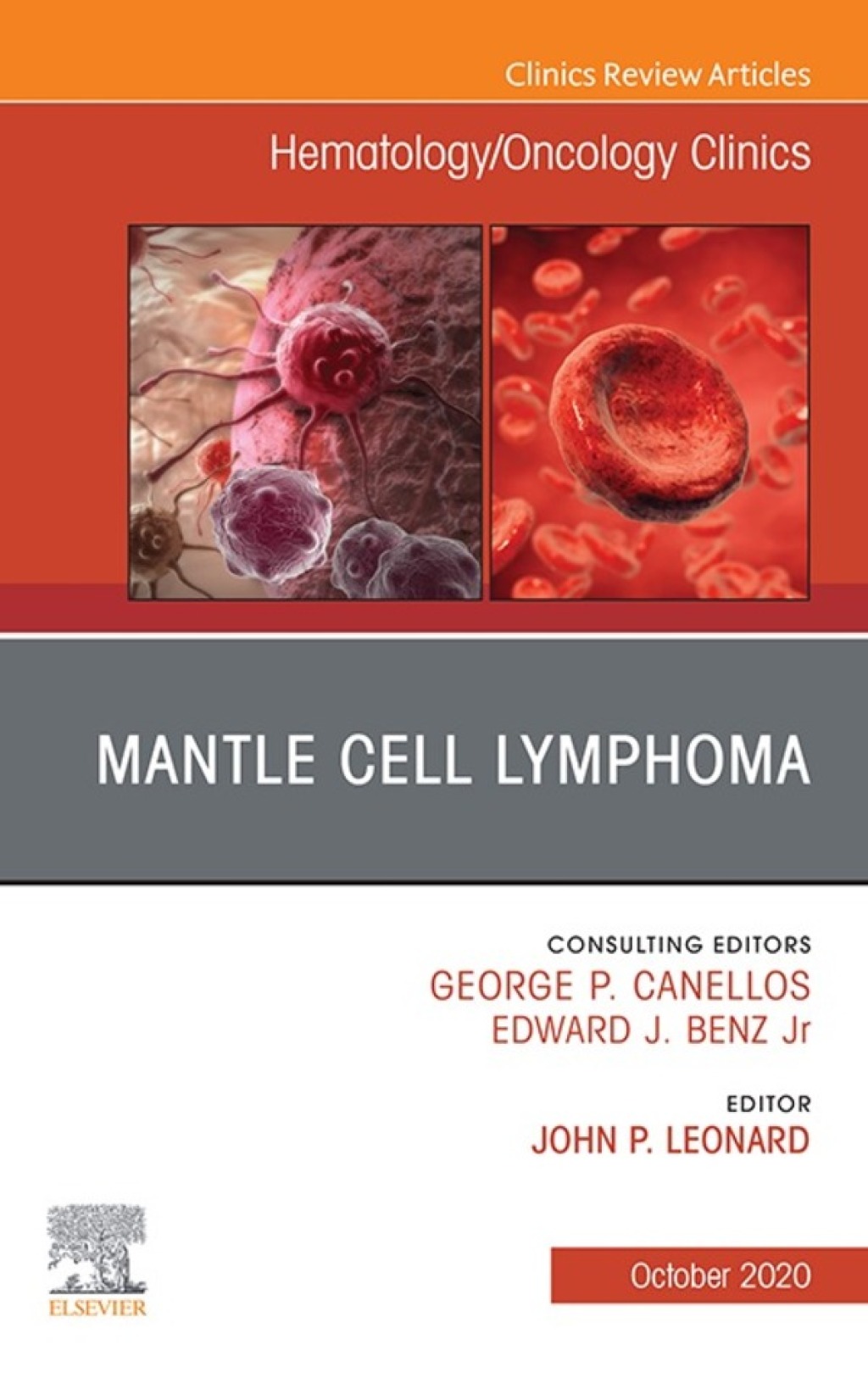 Mantle Cell Lymphoma, An Issue of Hematology/Oncology Clinics of North America 1st Edition