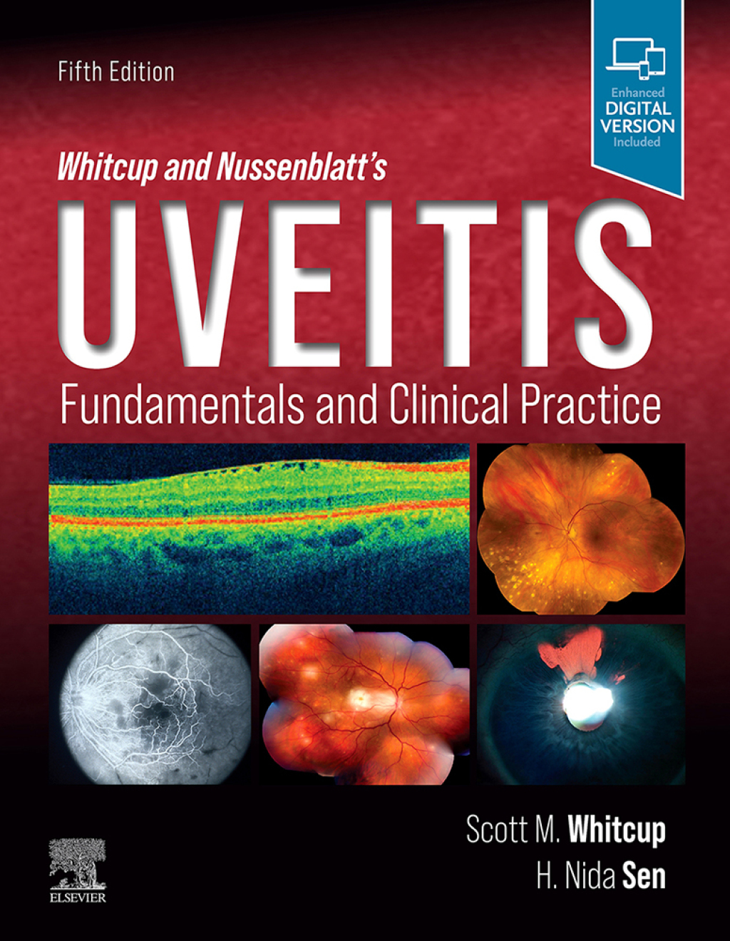 Whitcup and Nussenblatt's Uveitis Fundamentals and Clinical Practice 5th Edition
