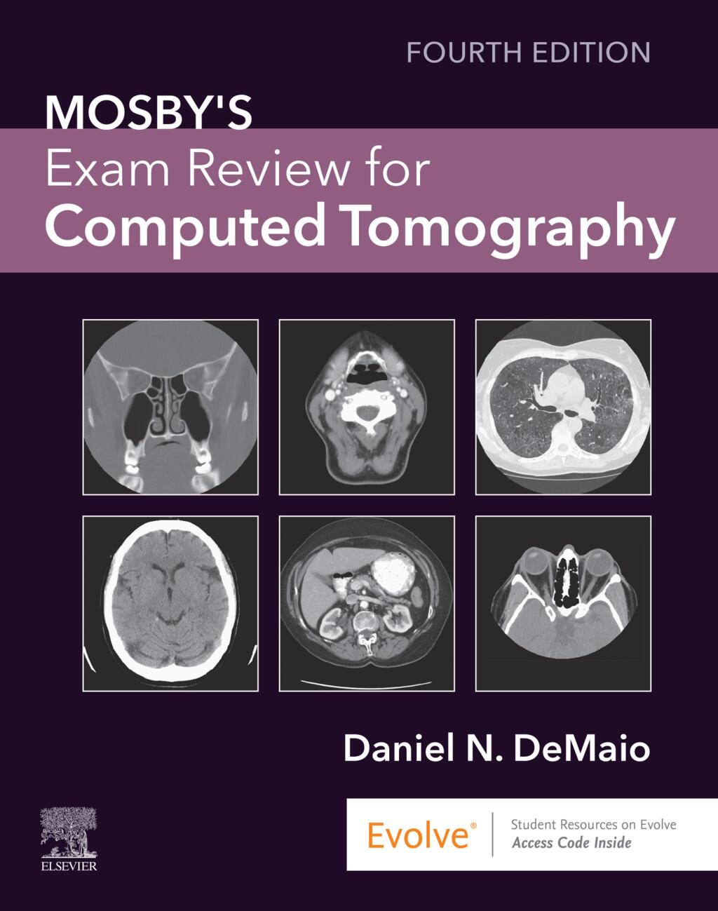 Mosby’s Exam Review for Computed Tomography 4th Edition