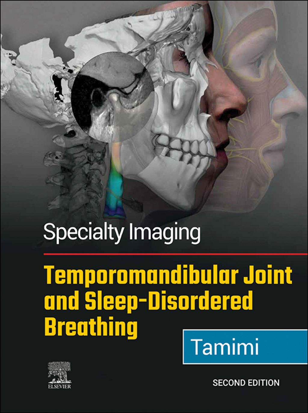 Specialty Imaging: Temporomandibular Joint and Sleep-Disordered Breathing 2nd Edition