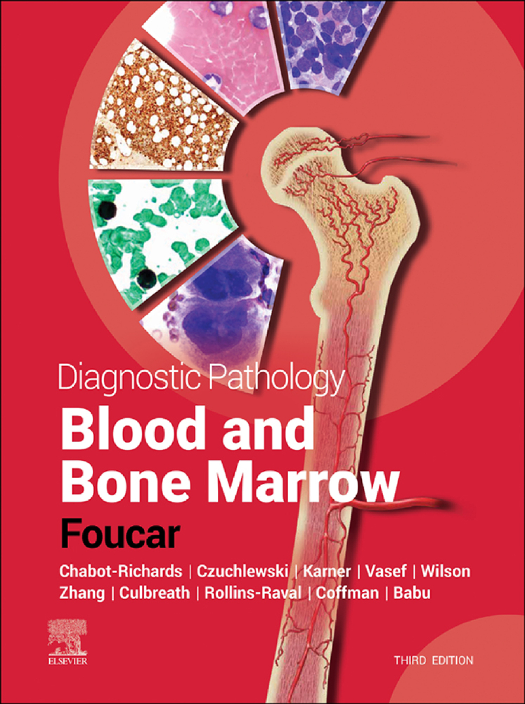 Diagnostic Pathology: Blood and Bone Marrow 3rd Edition