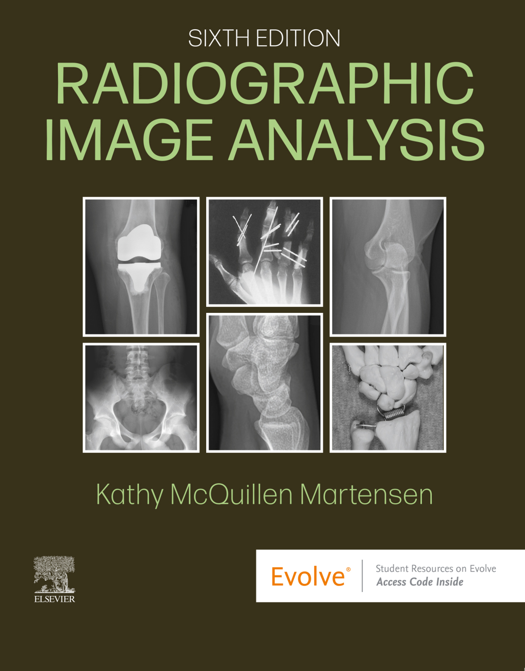 Radiographic Image Analysis 6th Edition