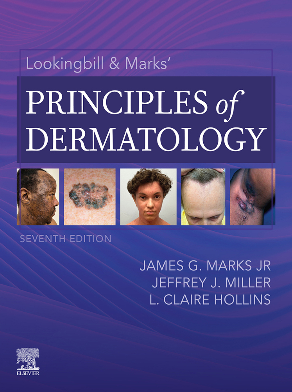 Lookingbill & Marks’ Principles of Dermatology 7th Edition